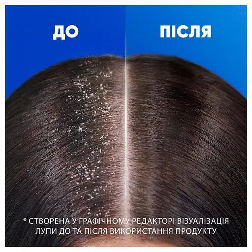 Шампунь Проти лупи Head & shoulders для жирного волосся Цитрусова свіжість 2 в 1 330 мл 052144 фото